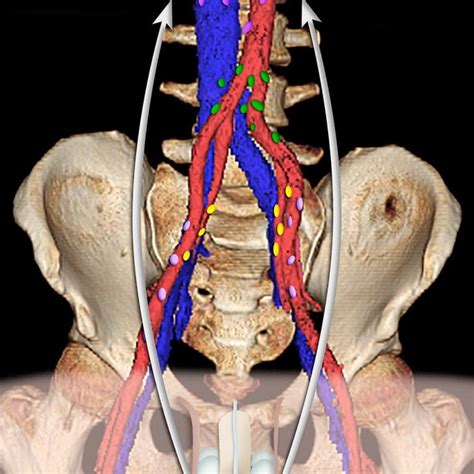 Pelvic lymph nodes and pathways of disease spread in male pelvic malignancies | Request PDF