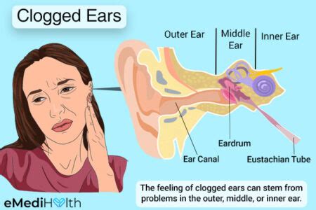 Clogged Ears: Causes, Symptoms, and Treatment Options