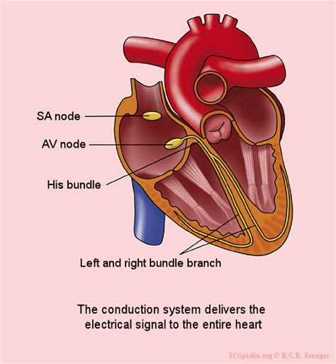 Normal sinus rhythm - wikidoc