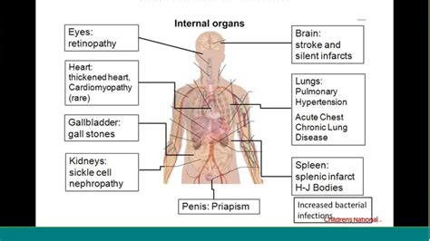 Describe the Symptoms of Sickle Cell Anemia - HarrykruwPerez