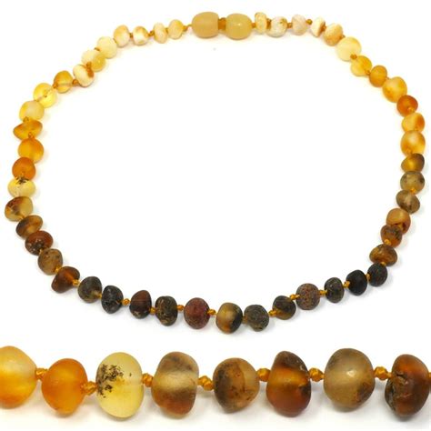 Amber Teething Necklaces: Do They Work? Are They Safe?