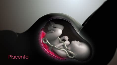 Medical Animation Showing Cesarean Section Surgery