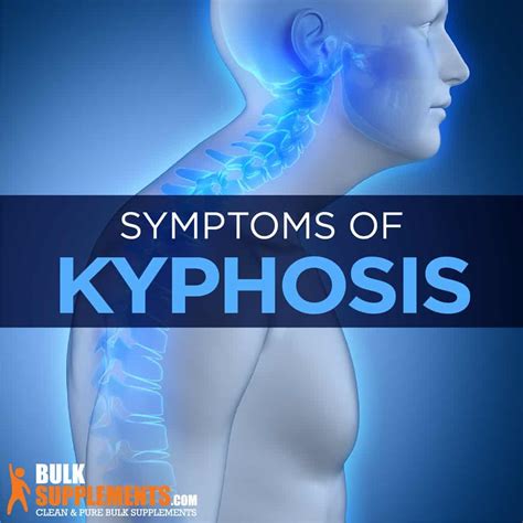 Kyphosis: Symptoms, Causes & Treatment