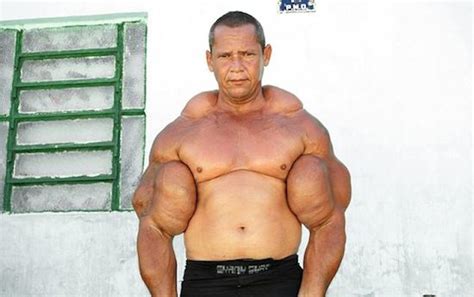 TOP 10 Bodybuilders Before and After Steroid Detransformation