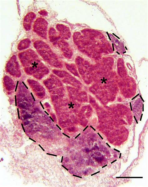 Pineal Gland Cross Section