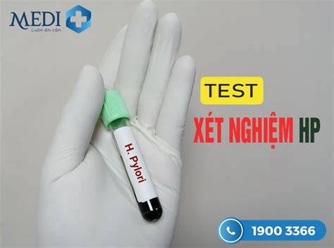 Xét nghiệm HP (test HP) dạ dày, Khi nào thì nên thực hiện?