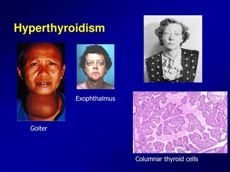 PPT - Thyroid Metabolic Hormones PowerPoint Presentation - ID:5702034