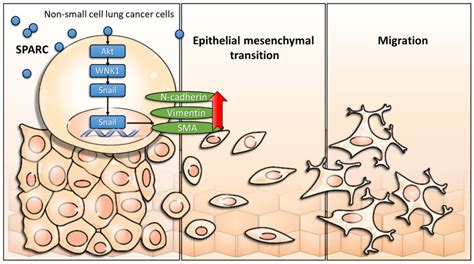 Scheme of proposed exogenous SPARC mediated signaling pathways in ...