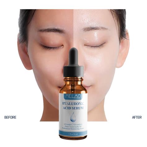 Melao Face Care Pure Hyaluronic Acid Serum Moisturizing Essence Skin ...