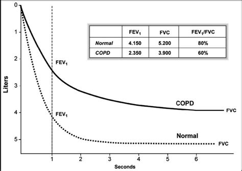 Spirometry Diagram