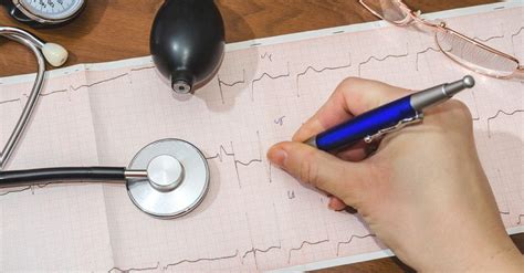 Trigeminy PVC: Definition, Causes, Treatment | Health education, Healthline, Pattern