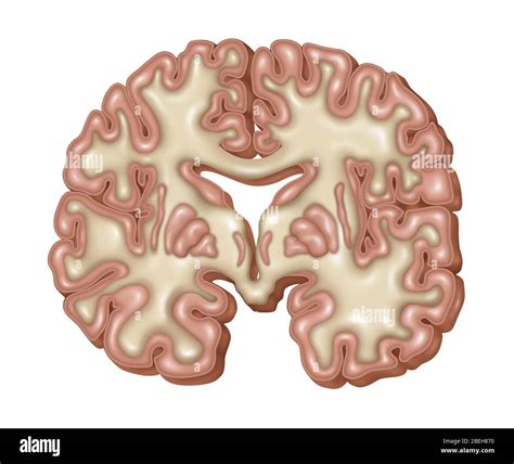 Normal Aging Brain Stock Photo - Alamy