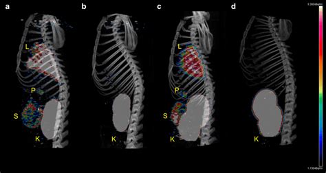 Representative sagittal maximum intensity projections of normal SD rat ...