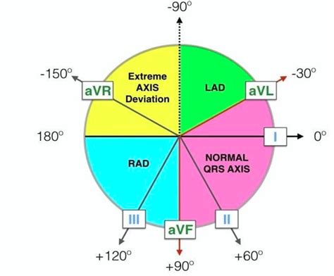 Ekg Axis