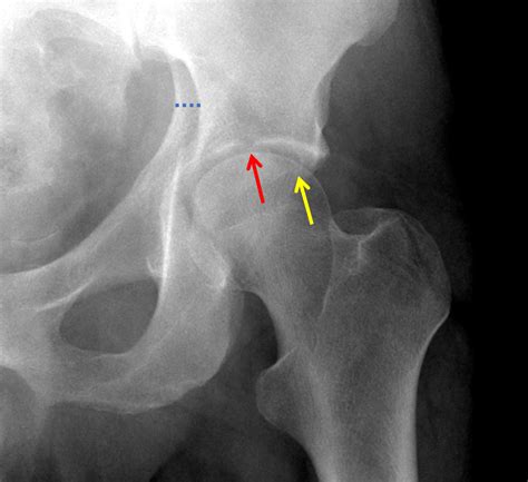 Msk Radiograph Case 8 | Free Nude Porn Photos