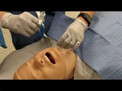 Surgical tracheostomy procedure - YouTube