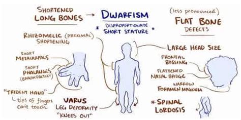 Understanding Dwarfism: Causes, Symptoms, And Treatments - Ask The Nurse Expert