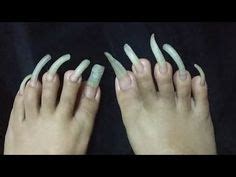 Long Ugly Toenails