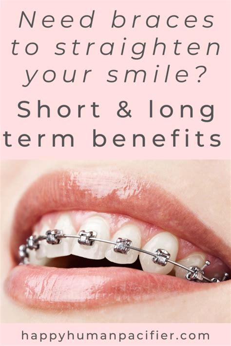 Short and Long Term Benefits of Braces | Happy Human Pacifier