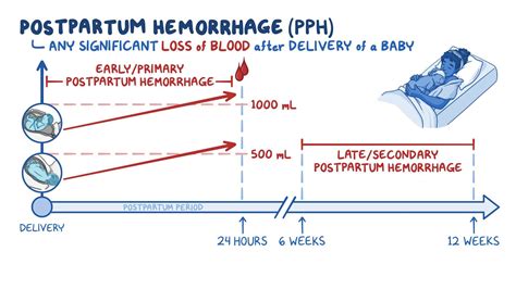 Postpartum hemorrhage: Nursing - Osmosis Video Library