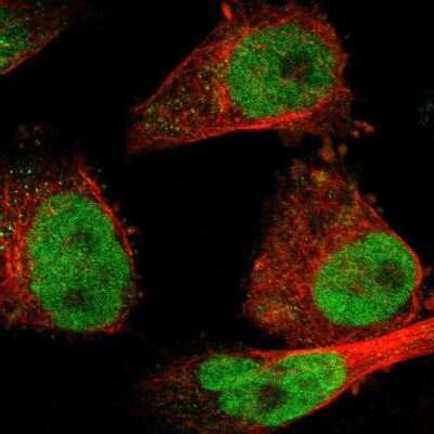 SSB Antibody (NBP1-82851): Novus Biologicals