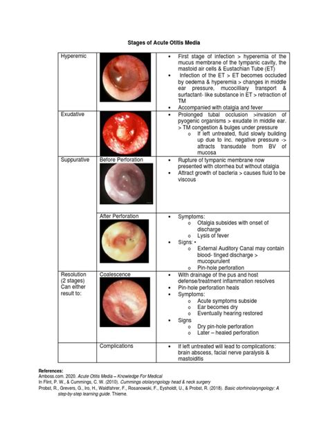 Stages of Acute Otitis Media | PDF | Surgical Specialties | Health Sciences