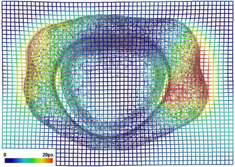 Visualization of the elastic deformation of one transformed image from... | Download Scientific ...