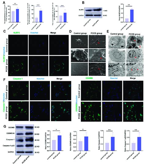 Hyperandrogenism causes pyroptosis of ovarian GCs by activating NLRP3 ...