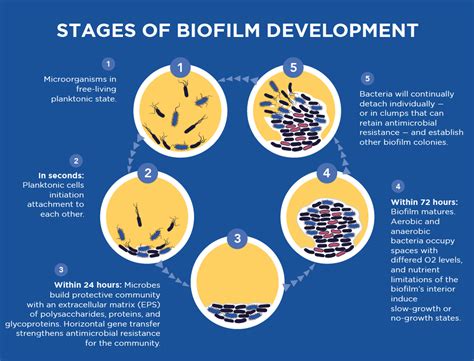 UROLOGY | Biofilm Detection | MicroGen Diagnostics