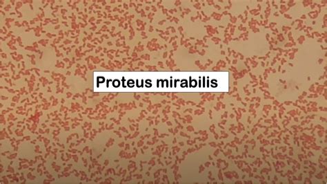 Proteus Mirabilis Microscope