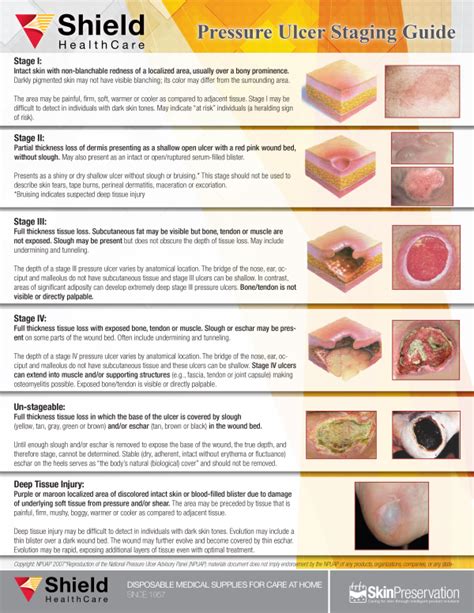 Pressure Ulcer Staging Guide | Wound care, Pressure ulcer, Wound care nursing