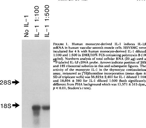 Figure 1 from Human interleukin 1 induces interleukin 1 gene expression in human vascular smooth ...