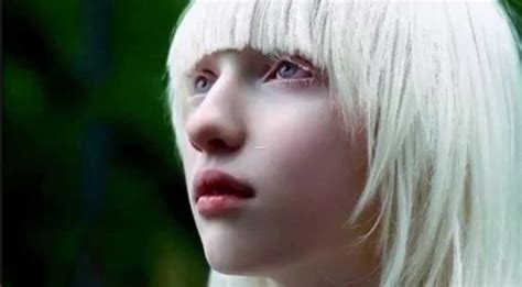 The science behind Albinism - CollegeFreakz