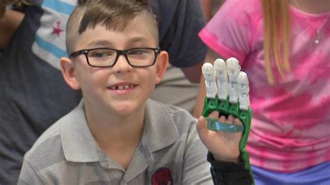 Middle school students' ingenuity helps boy born with only 6 fingers ...