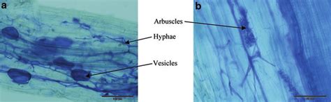 Microscopic visualization of Arbuscular mycorrhizal fungi (a) showing ...