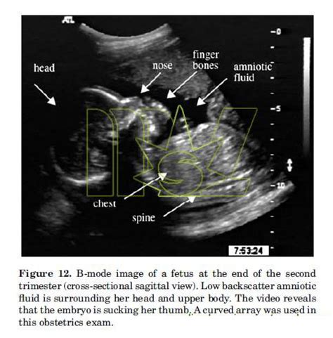 B-mode Ultrasound Imaging (The Definition of B Mode Ultrasound )