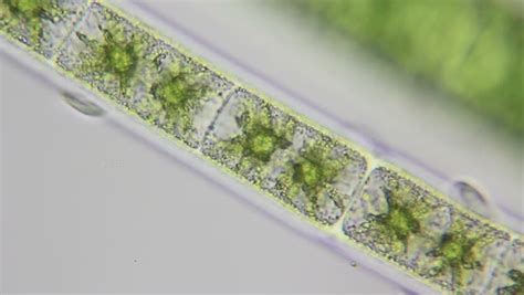 Ciliates on algae. Light microscope footage of ciliate protozoa moving along a filament of green ...