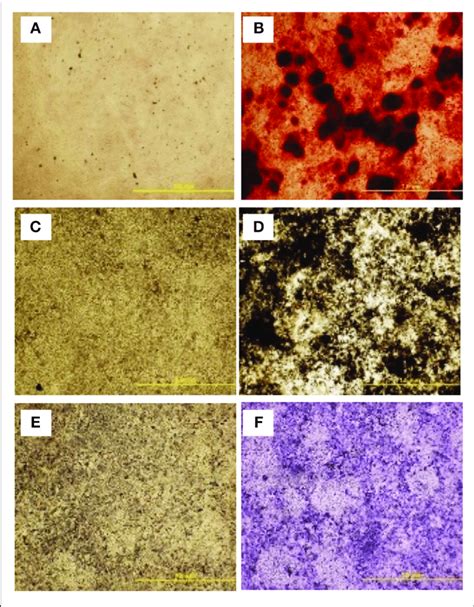 | Multilineage differentiation potential of cBMSCs. On confluency,... | Download Scientific Diagram