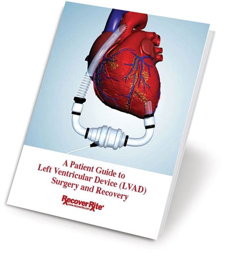 A Patient Guide to LVAD Surgery and Recovery – Recover Rite