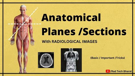 Anatomical Planes /Sections and its Importance in Radiology Department - YouTube