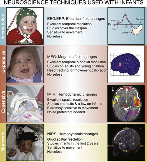 Figure 1 from Brain Mechanisms in Early Language Acquisition | Semantic Scholar