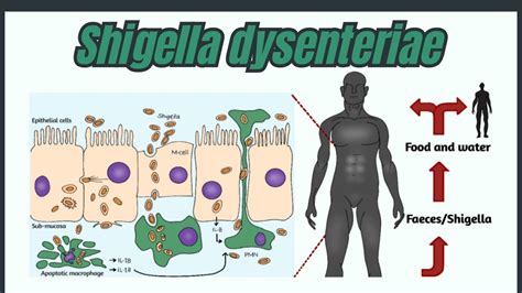 Shigella dysenteriae: Clinical Symptoms and Pathogenicity ...