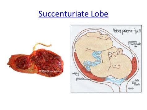 The placenta - odds and sods