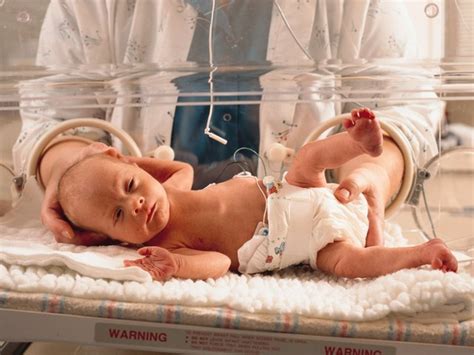 Challenges For Babies Born at 36 Weeks Pregnant | Livestrong.com