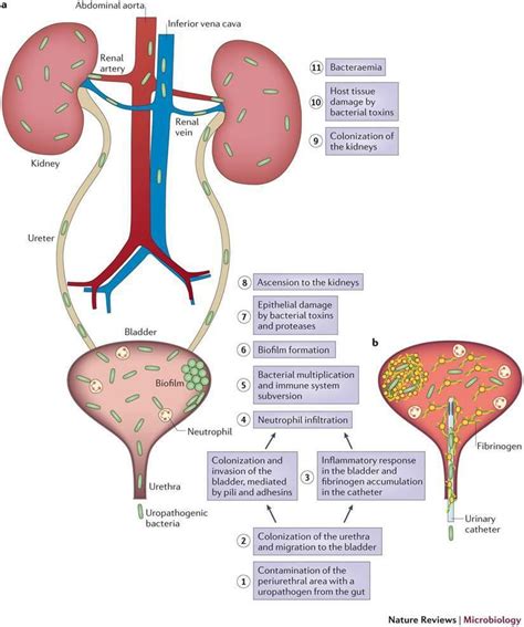 Proteus Vulgaris Disease Symptoms - Captions Tempo