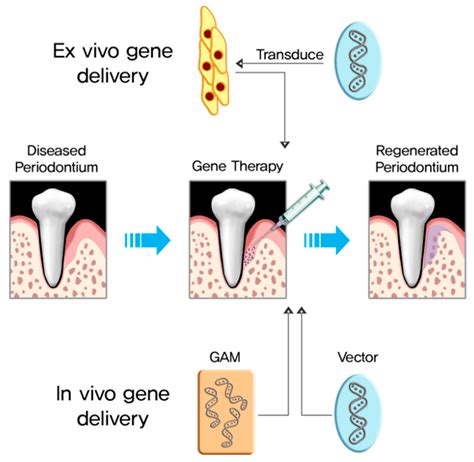 Pharmaceutics | Free Full-Text | BMP-2 Gene Delivery-Based Bone Regeneration in Dentistry