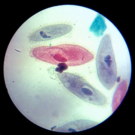 Under The Microscope: Paramecium | Office for Science and Society ...