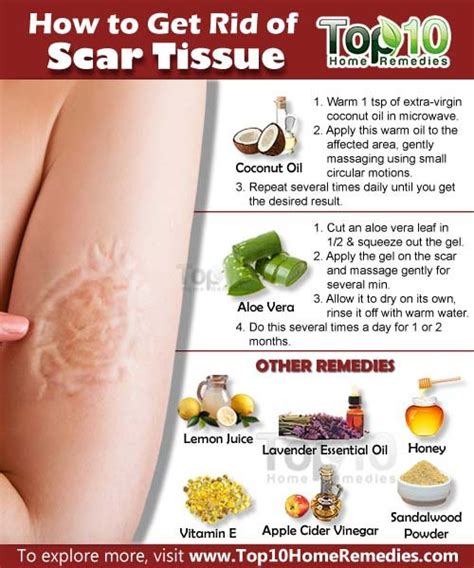 How to Get Rid of Scar Tissue | Top 10 Home Remedies