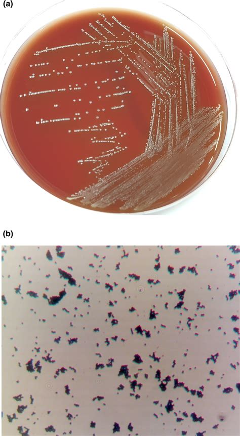 Aerococcus viridans identification. (a) Gram's stain the A. viridans... | Download Scientific ...