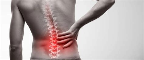 Chiropractic Care for Back Pain – Common Questions